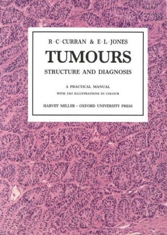 Tumors: Structure and Diagnosis