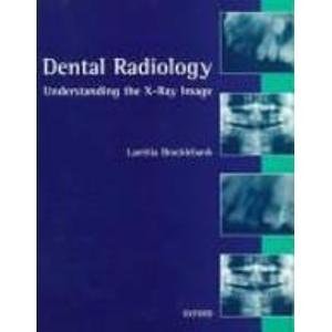 Dental Radiology: Understanding the X-ray Image
