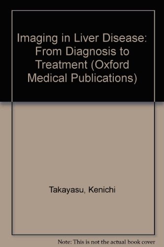 Imaging in Liver Disease: From Diagnosis to Treatment