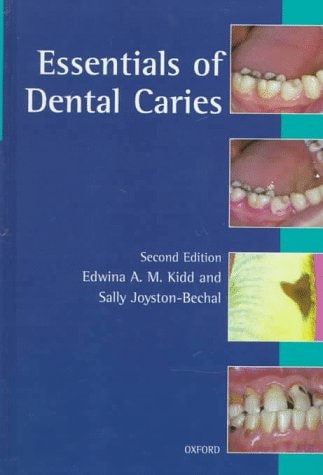 Essentials of Dental Caries