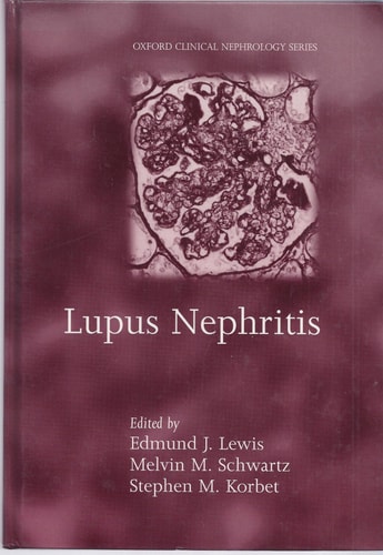 Lupus Nephritis