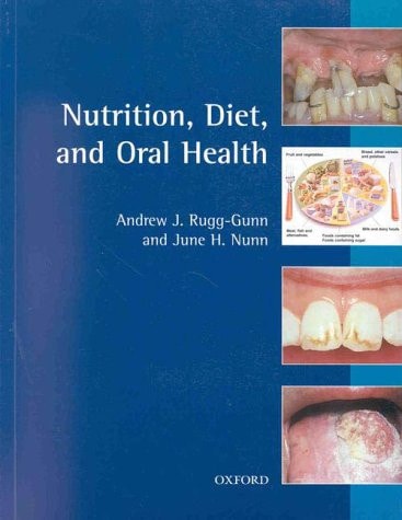 Nutrition, Diet, and Oral Health