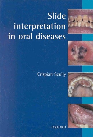 Slide Interpretation in Oral Diseases