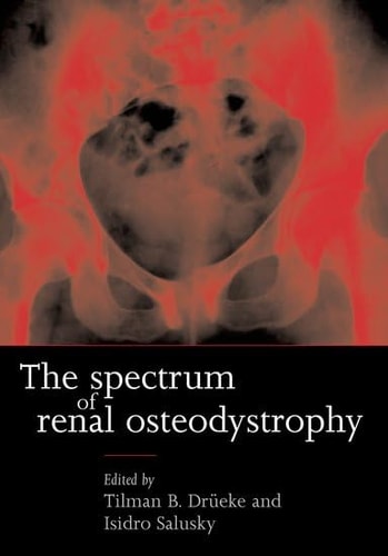 The Spectrum of Renal Osteodystrophy