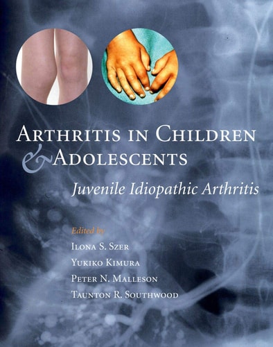 Arthritis in Children and Adolescents: Juvenile Idiopathic Arthritis