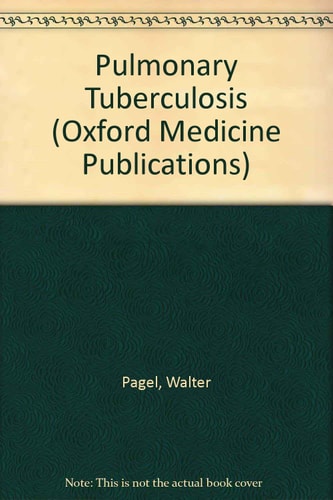 Pulmonary Tuberculosis
