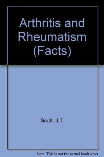 Arthritis and Rheumatism: Facts