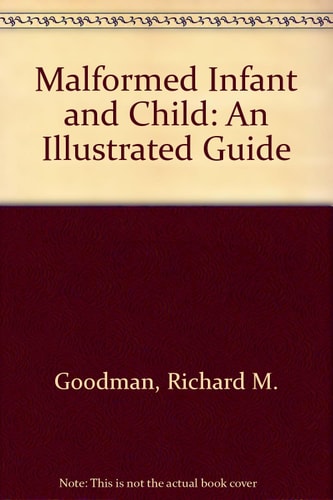 Malformed Infant and Child