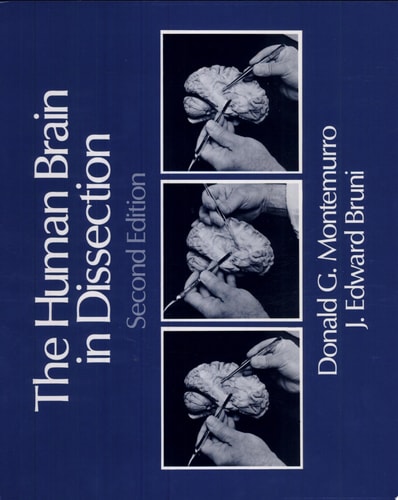 The Human Brain in Dissection