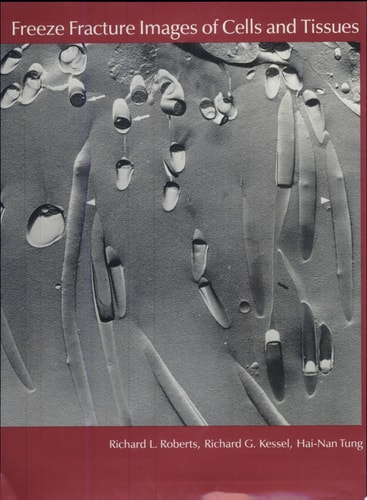 Freeze Fracture Images of Cells and Tissues