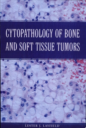 Cytopathology of Bone and Soft Tissue Tumors
