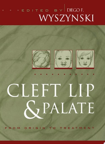Cleft Lip and Palate From Origin to Treatment