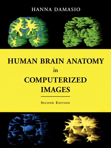 Human Brain Anatomy in Computerized Images