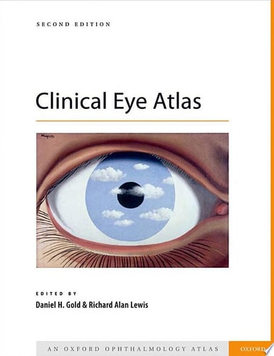 Clinical Eye Atlas