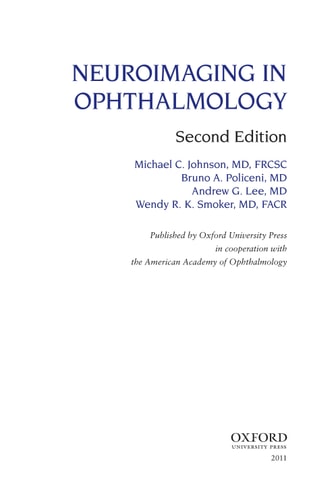 Neuroimaging in Ophthalmology