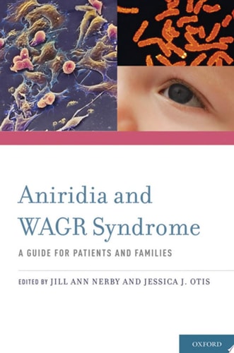 Aniridia and WAGR Syndrome A Guide for Patients and Their Families