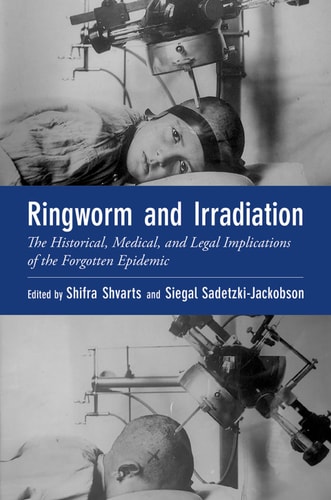 Ringworm and Irradiation: The Historical, Medical, and Legal Implications of the Forgotten Epidemic
