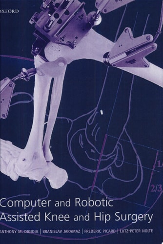 Computer and Robotic Assisted Hip and Knee Surgery
