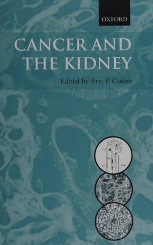 Cancer and the Kidney
