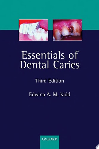 Essentials of Dental Caries: The Disease and Its Management