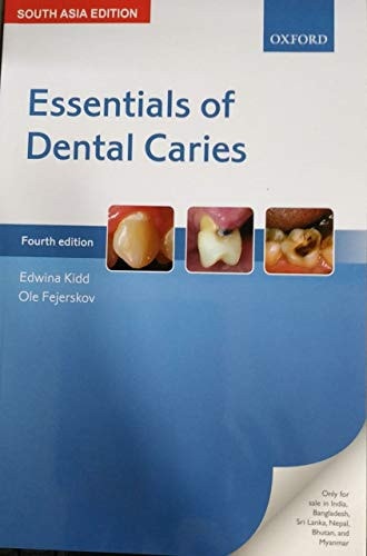 Essentials of Dental Caries