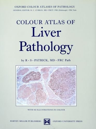 Colour Atlas of Liver Pathology