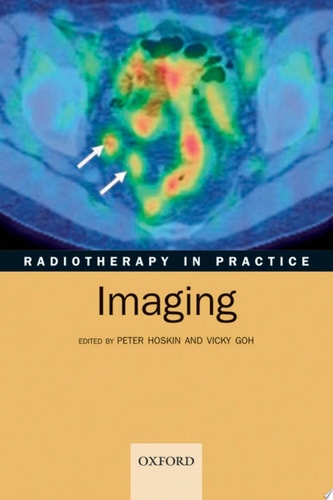 Radiotherapy in Practice: Imaging