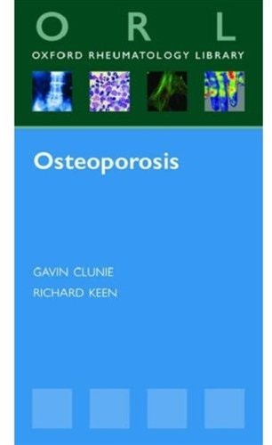 Osteoporosis