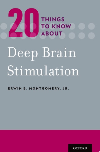 20 Things to Know About Deep Brain Stimulation