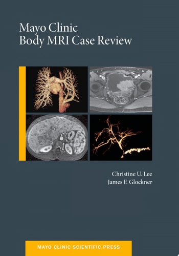 Mayo Clinic Body MRI Case Review (Mayo Clinic Scientific Press)