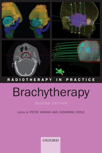 Radiotherapy in Practice: Brachytherapy