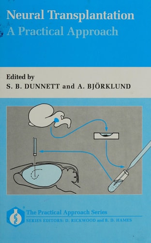 Neural Transplantation: A Practical Approach