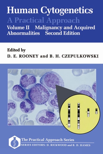 Human Cytogenetics: A Practical Approach Volume II: Malignancy and Acquired Abnormalities