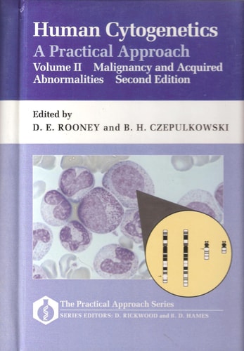 Human Cytogenetics: A Practical Approach Volume II: Malignancy and Acquired Abnormalities