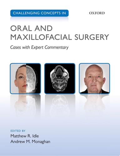 Challenging Concepts in Oral and Maxillofacial Surgery Cases with Expert Commentary