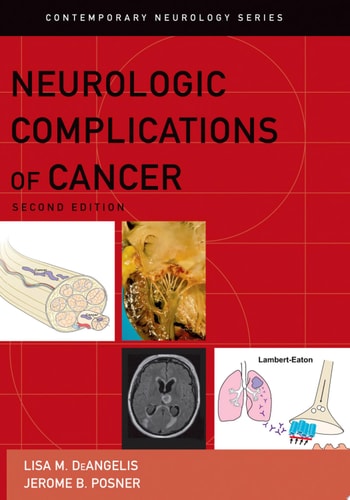 Neurologic Complications of Cancer