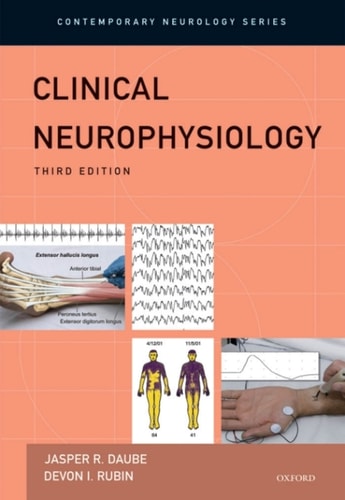 Clinical Neurophysiology