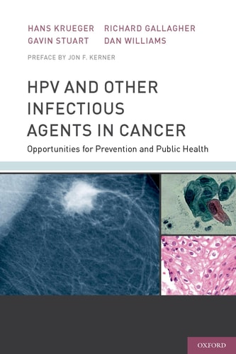 HPV and Other Infectious Agents in Cancer Opportunities for Prevention and Public Health