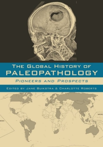 Global History of Paleopathology: Pioneers and Prospects
