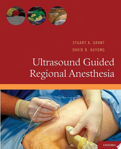 Ultrasound Guided Regional Anesthesia