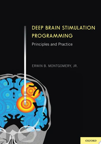 Deep Brain Stimulation Programming