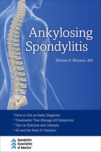Ankylosing Spondylitis: The Facts