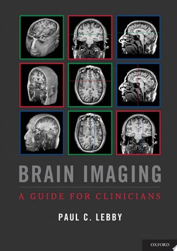 Brain Imaging: A Guide for Clinicians
