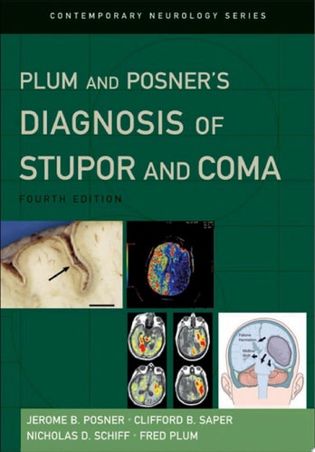 Plum and Posner's Diagnosis of Stupor and Coma (Contemporary Neurology Series Book 71)