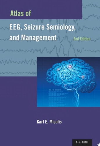 Atlas of EEG, Seizure Semiology, and Management