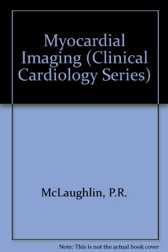 Myocardial Imaging