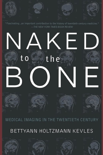 Naked to the Bone: Medical Imaging in the Twentieth Century