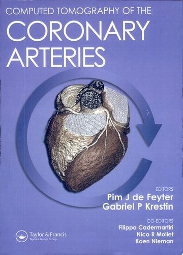 Computed Tomography of the Coronary Arteries
