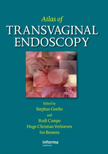 Atlas of Transvaginal Endoscopy