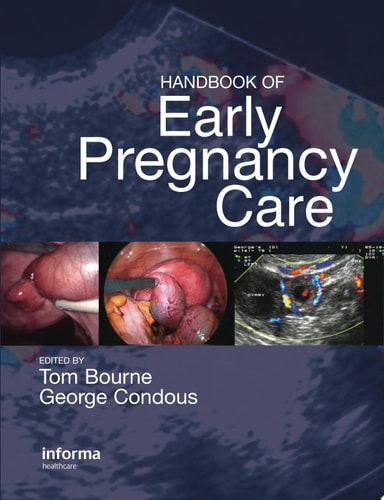 Handbook of Early Pregnancy Care